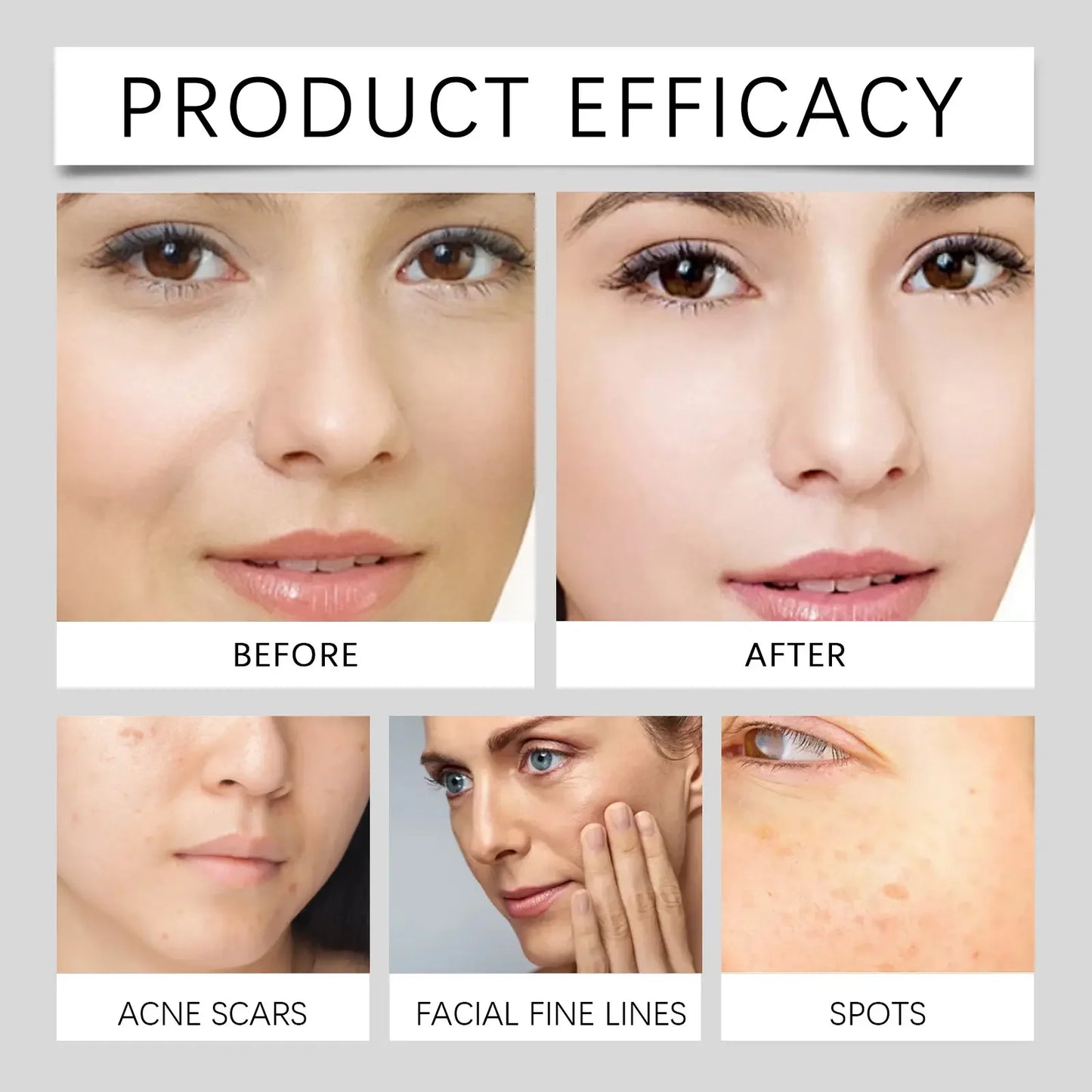Ae™ Whitening & Freckle Removing Essence