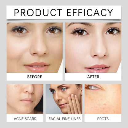 Ae™ Whitening & Freckle Removing Essence